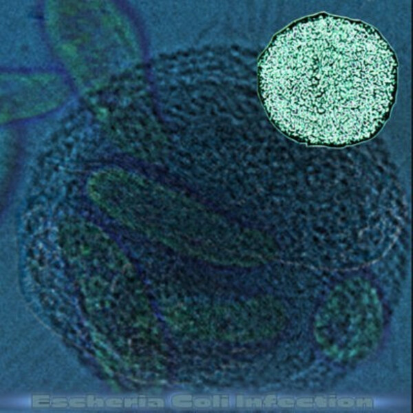Escherichia Coli Infection by Embryonic Cell Division (Album): Reviews ...